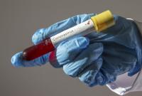 ВОЗ обеспокоена случаями коронавируса без четкой связи с Китаем