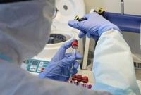 Меньше 700: в Украине сокращается число новых случаев коронавируса