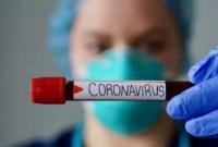 Минздрав планирует увеличить количество ПЦР-тестов на коронавирус от 15 до 20 тысяч в сутки