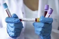 В Украине за сутки обнаружено более 3700 новых случаев коронавируса