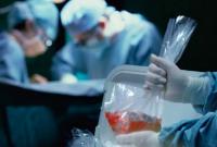 У МОЗ розповіли, скільки українців щороку потребують трансплантації
