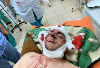 "Покушение на убийство": на Сумщине жестоко избили экс-мэра Конотопа Семенихина (видео)