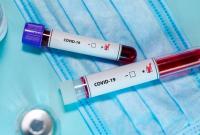 В Украине COVID-19 болеет 78 детей В Украине COVID-19 болеет 78 детей
