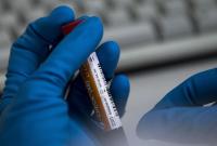 Необходимые тест-системы для выявления коронавируса на Буковине поступят в Украине 12 марта